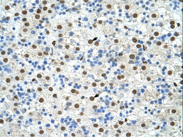 EXOSC4 / RRP41 Antibody (N-Terminus)