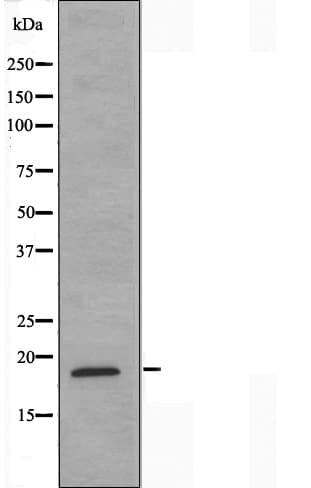 Polyclonal Rabbit anti-Human MECOM / EVI1 Antibody (IF, WB)