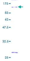 Human KIND2 / FERMT2 Protein (Recombinant GST)