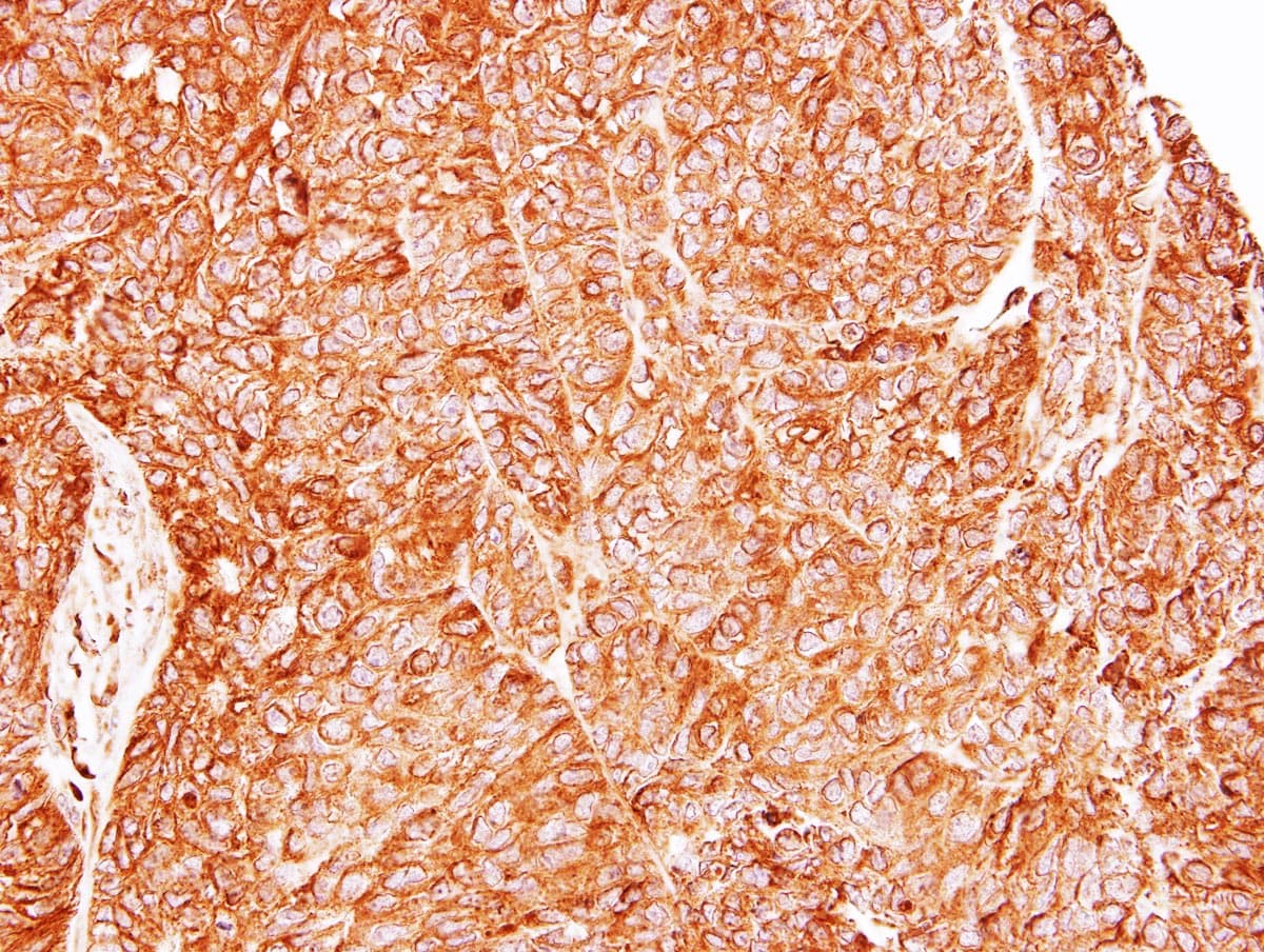 TC21 / RRAS2 Antibody (aa1-204)