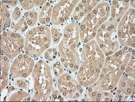 TYRO3 Antibody (clone OTI2D11)