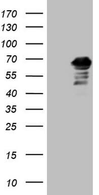 Monoclonal Mouse anti-Human CNOT2 Antibody (clone OTI9B10, IHC, WB)