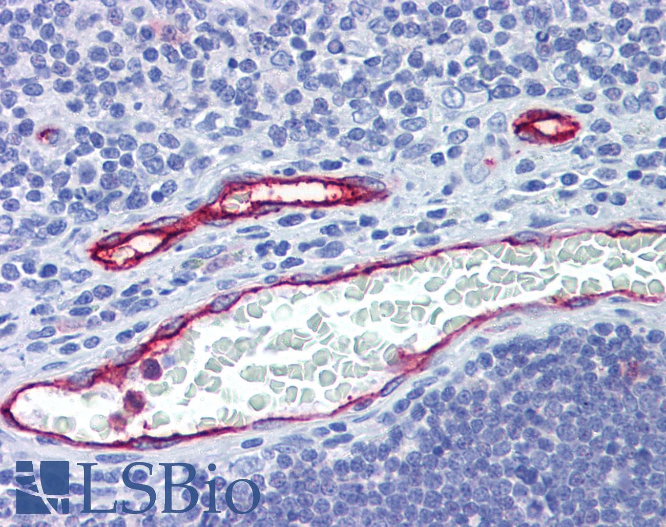 IHC-plus™ ACKR1 / DARC Antibody (aa1-50)