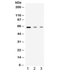 AMHR2 / MISRII Antibody