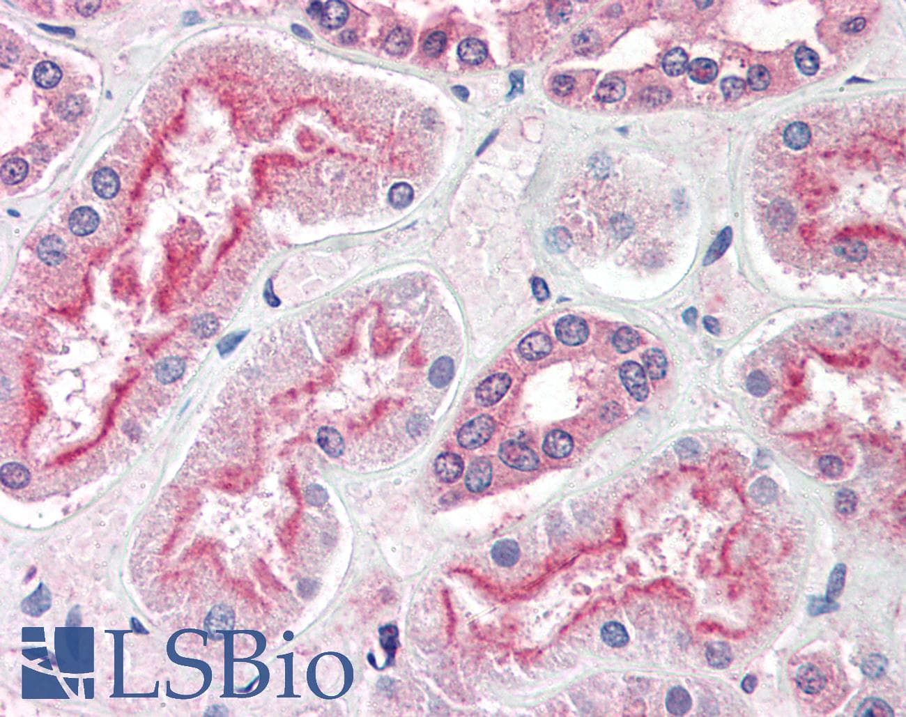 IHC-plus™ ADAM20 Antibody (Internal)