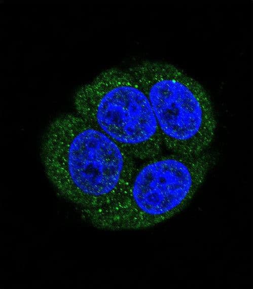 LTA4H / LTA4 Antibody (aa163-191)