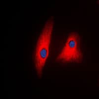 Polyclonal Rabbit anti-Human PLCG1 Antibody (C-Terminus, IF, WB)