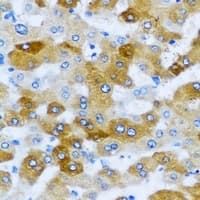 KLK10 / Kallikrein 10 Antibody
