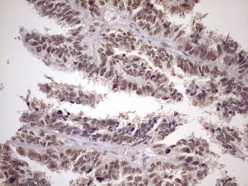 ATF1 Antibody (clone OTI2B4)