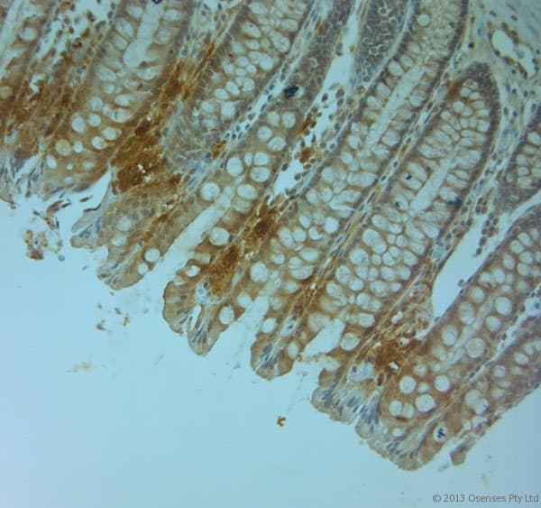PLIN4 / S3-12 Antibody (aa1050-1100)