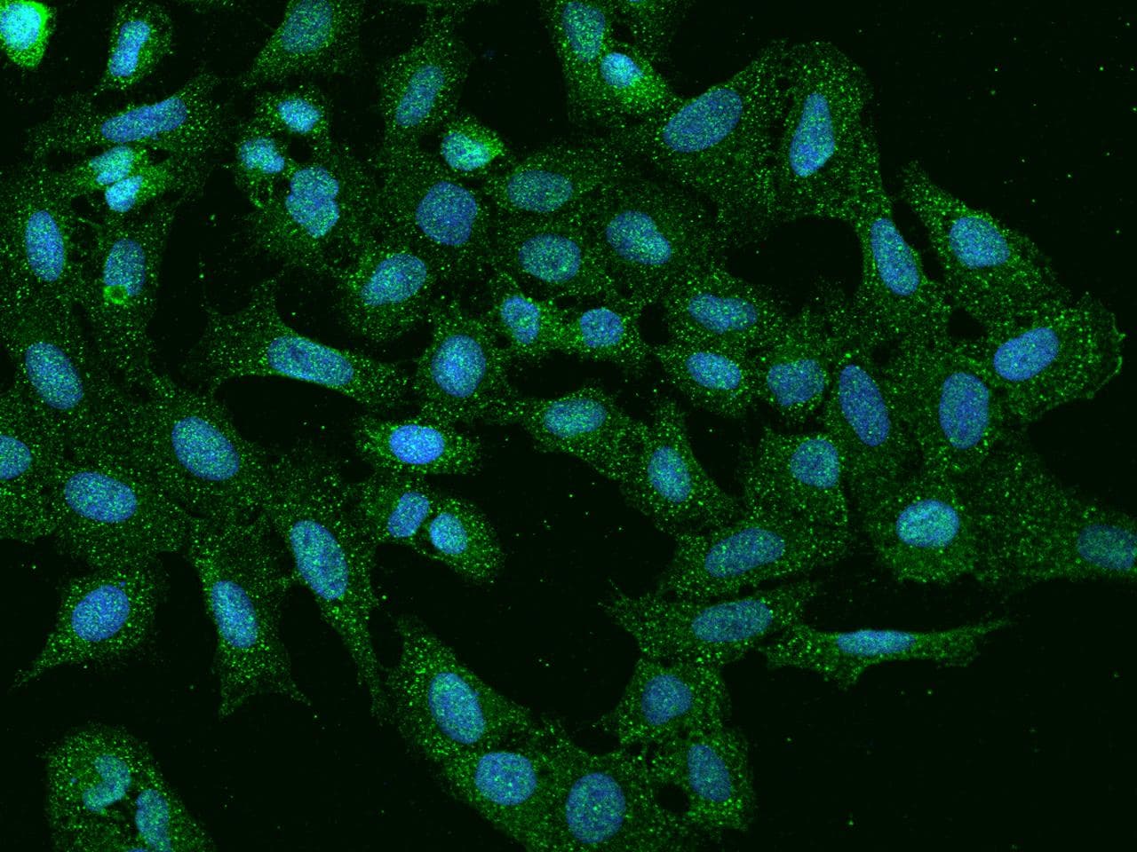 PLEKHH2 Antibody