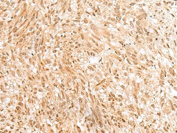 RBM19 Antibody
