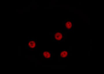 MEF2A / MEF2 Antibody