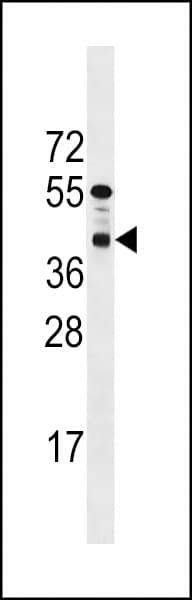 PPTC7 Antibody (aa239-267)