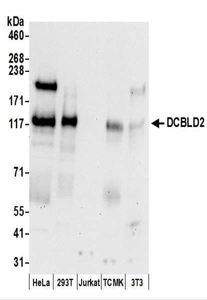 Polyclonal Rabbit anti-Human DCBLD2 Antibody (aa725-775, WB)