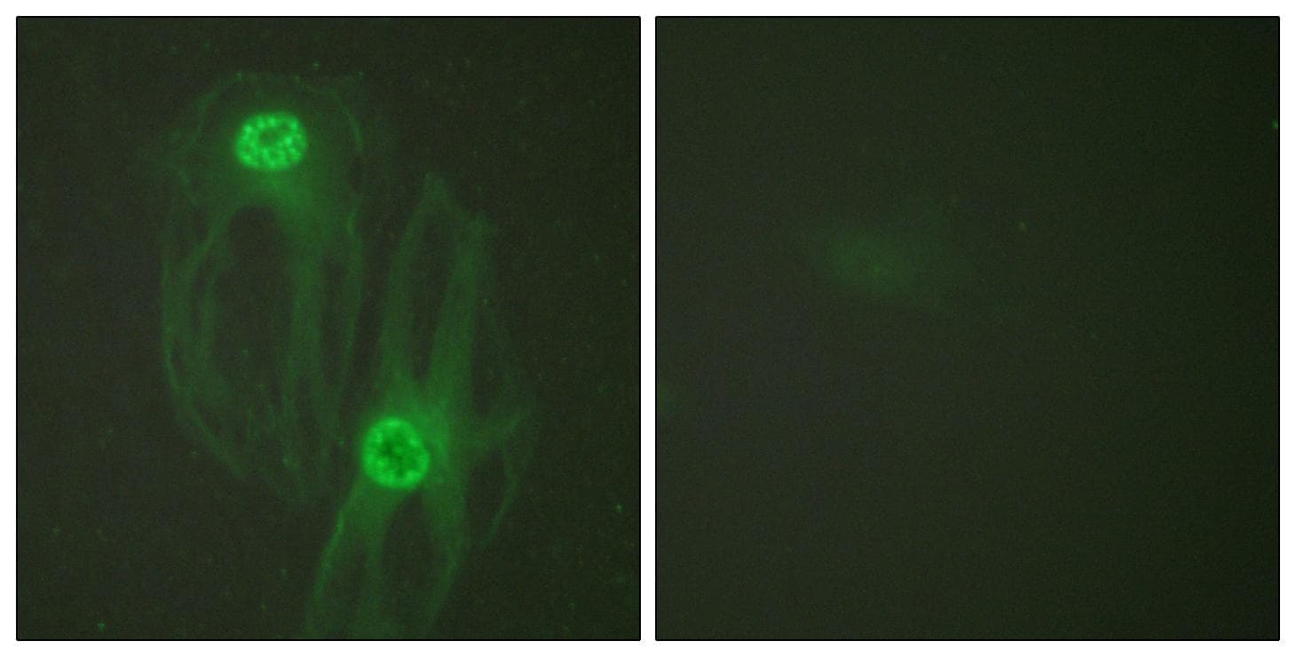 KIF11 / EG5 Antibody (p927)