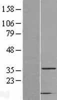 CAPZA2 / CAPZ Alpha 2 Protein (Over-Expression Lysate Myc-DDK (Flag))