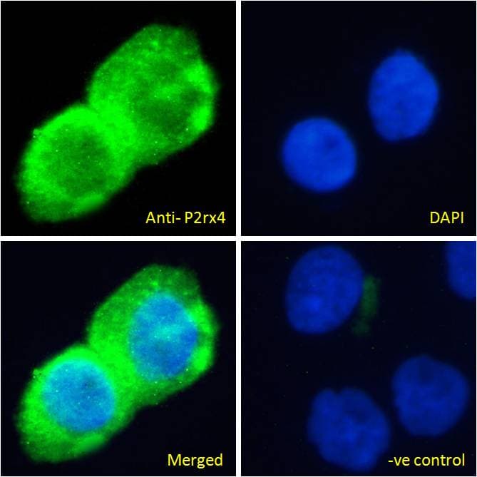 IHC-plus™ P2RX4 / P2X4 Antibody (aa56-69)