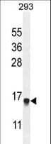 Polyclonal Rabbit anti-Human ENSA Antibody (aa39-66, WB)