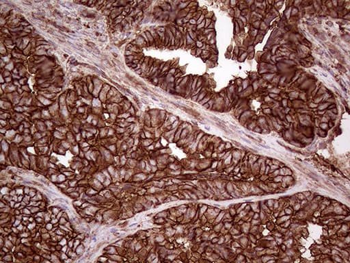 Monoclonal Mouse anti-Human IQGAP1 Antibody (clone OTI5F9, aa464-609, IHC, WB)