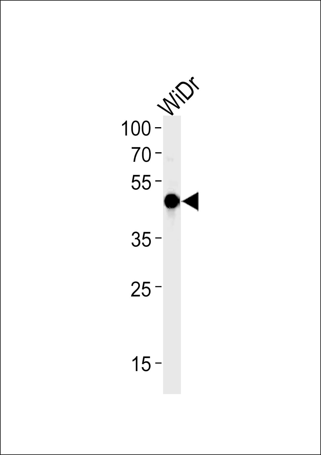 HNF4G / HNF4 Gamma Antibody (aa70-100)