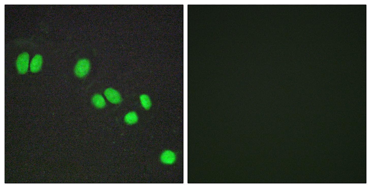 NCOR2 / SMRT Antibody