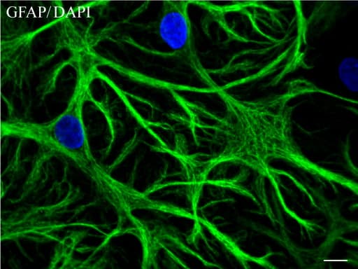 Monoclonal Mouse anti-Human GFAP Antibody (clone UMAB129, IHC, IF, WB)