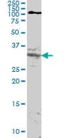HOXA11 Antibody (clone 8B8)