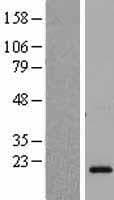 Human CSH2 / Placental Lactogen Protein (Over-Expression Lysate Myc-DDK (Flag))