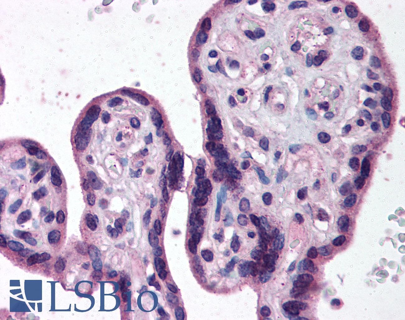 IHC-plus™ IKBKB / IKK2 / IKK Beta Antibody (C-Terminus)