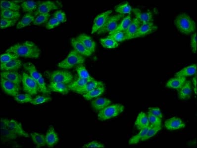 REM1 / REM-1 Antibody