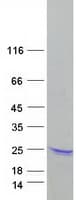 Human ARPC5 / p16-Arc Protein (Recombinant Myc-DDK (Flag))