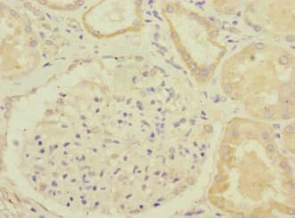 Polyclonal Rabbit anti-Human GBF1 Antibody (IHC, IF)