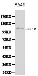 IGF1R / IGF1 Receptor Antibody