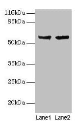IHC-plus™ CYP17 / CYP17A1 Antibody (aa1-508)