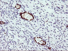 ERG Antibody (clone OTI6A4)