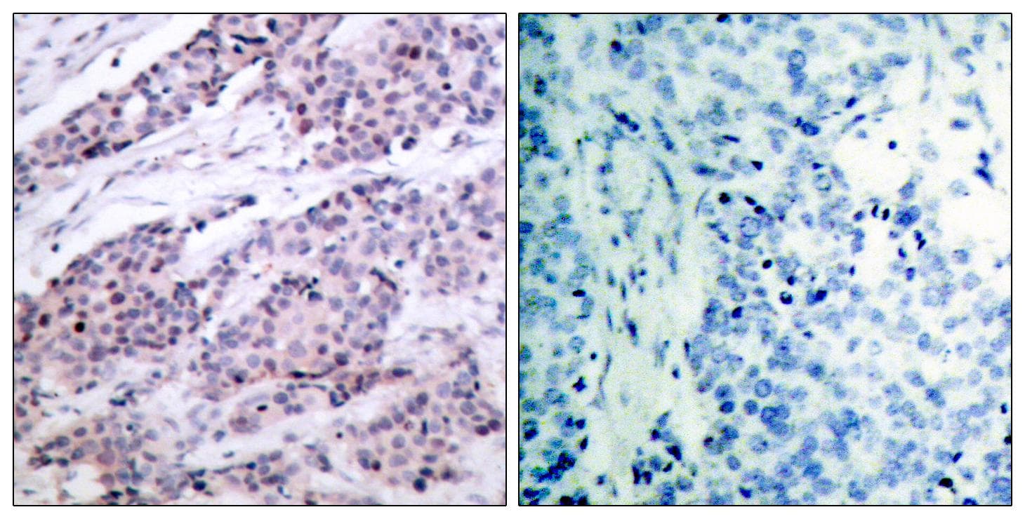 Polyclonal Rabbit anti-Human BCL2 / Bcl-2 Antibody (p56, IHC, WB)