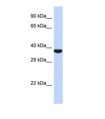 Polyclonal Rabbit anti-Human TMPPE Antibody (aa83-132, WB)