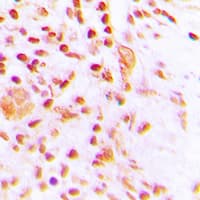 PEA3 / ETV4 Antibody (Internal)