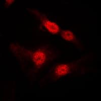 Polyclonal Rabbit anti-Human DGKA Antibody (Internal, IHC, IF, WB)