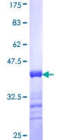 Human STAB1 Protein (Recombinant GST, N-terminus)