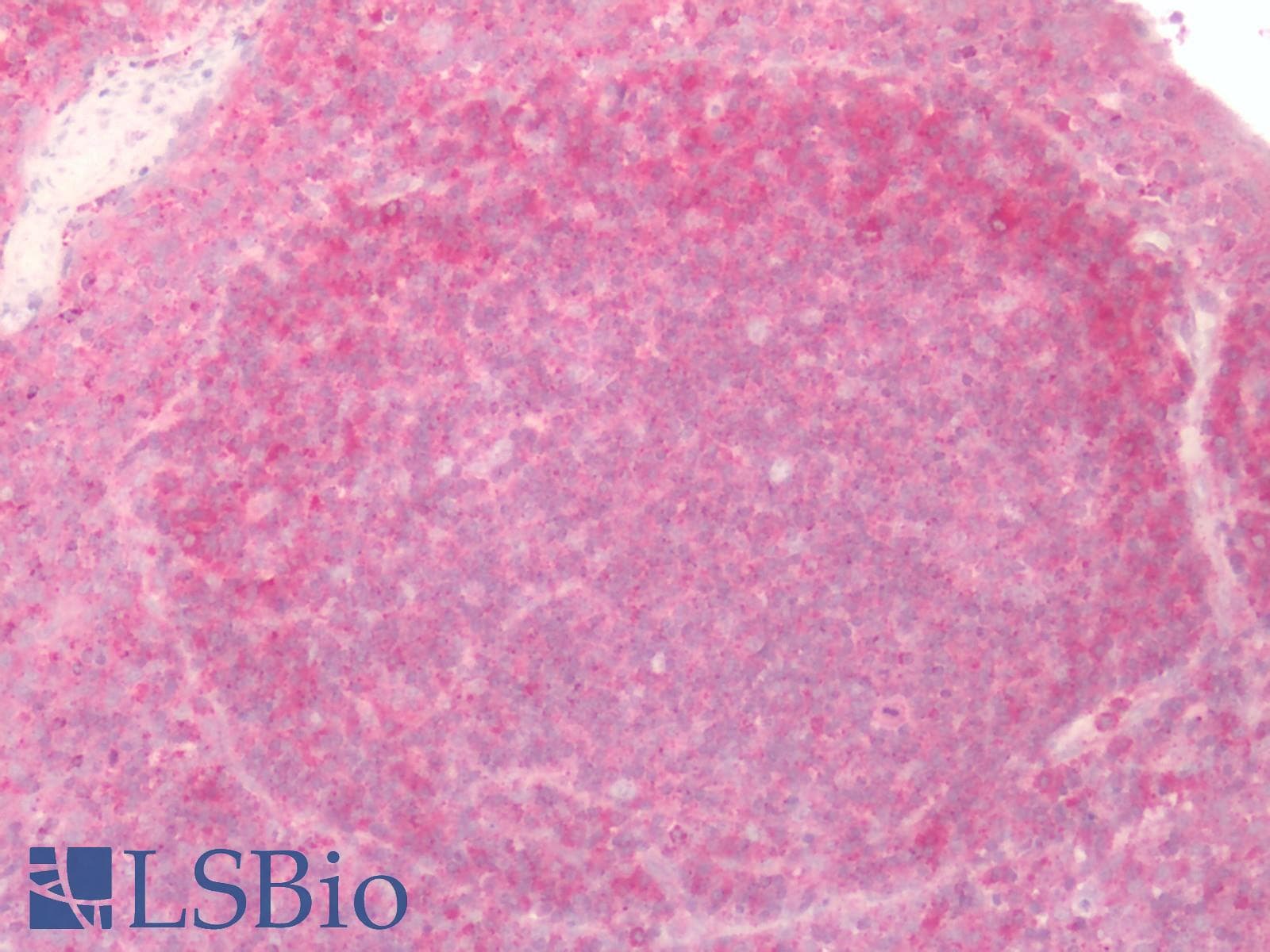 PathPlus™ Polyclonal Rabbit anti-Human GPER1 / GPR30 Antibody (C-Terminus, IHC, IF, WB)
