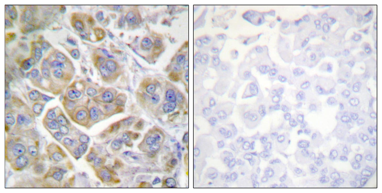 Polyclonal Rabbit anti-Human ITGB4 / Integrin Beta 4 Antibody (aa1481-1530, IHC, WB)