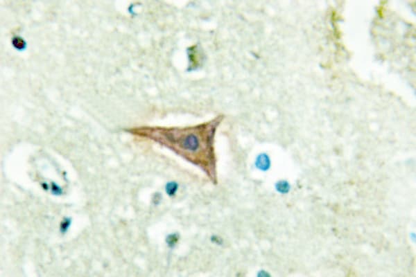 Polyclonal Rabbit anti-Human EFNA5 / Ephrin A5 Antibody (Pro63, IHC, IF, WB)