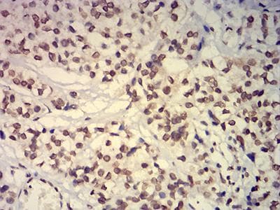 Monoclonal Mouse anti-Human EHMT2 / G9A Antibody (clone 2D12A11, IHC, WB)
