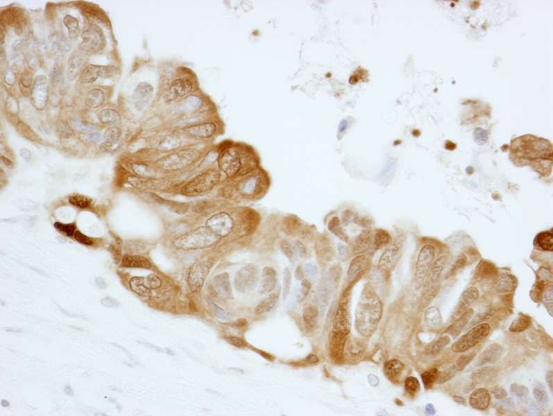 Polyclonal Rabbit anti-Human SFN / Stratifin / 14-3-3 Sigma Antibody (aa198-248, IHC, IF)