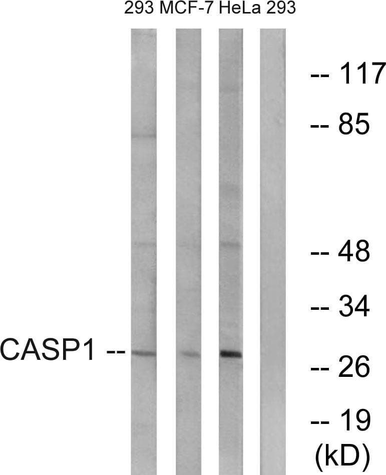 Polyclonal Rabbit anti-Human CASP1 / Caspase 1 Antibody (p376, IHC, WB)
