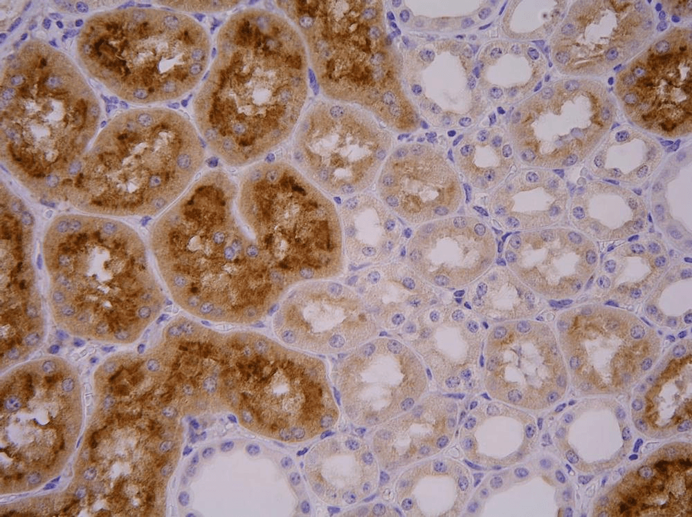 FOLH1 / PSMA Antibody (clone GCP-04)