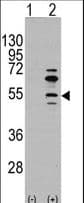 IHC-plus™ Polyclonal Rabbit anti-Human MEF2C Antibody (Ser59, IHC, WB)