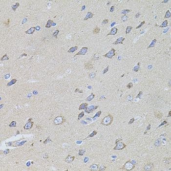 CCN5 Antibody